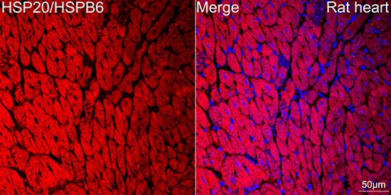 HSP20/HSPB6 Antibody (3J5N1)