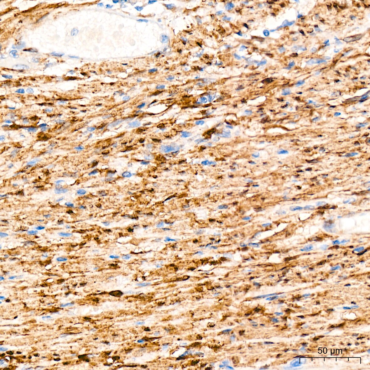 HSP20/HSPB6 Antibody (3J5N1)