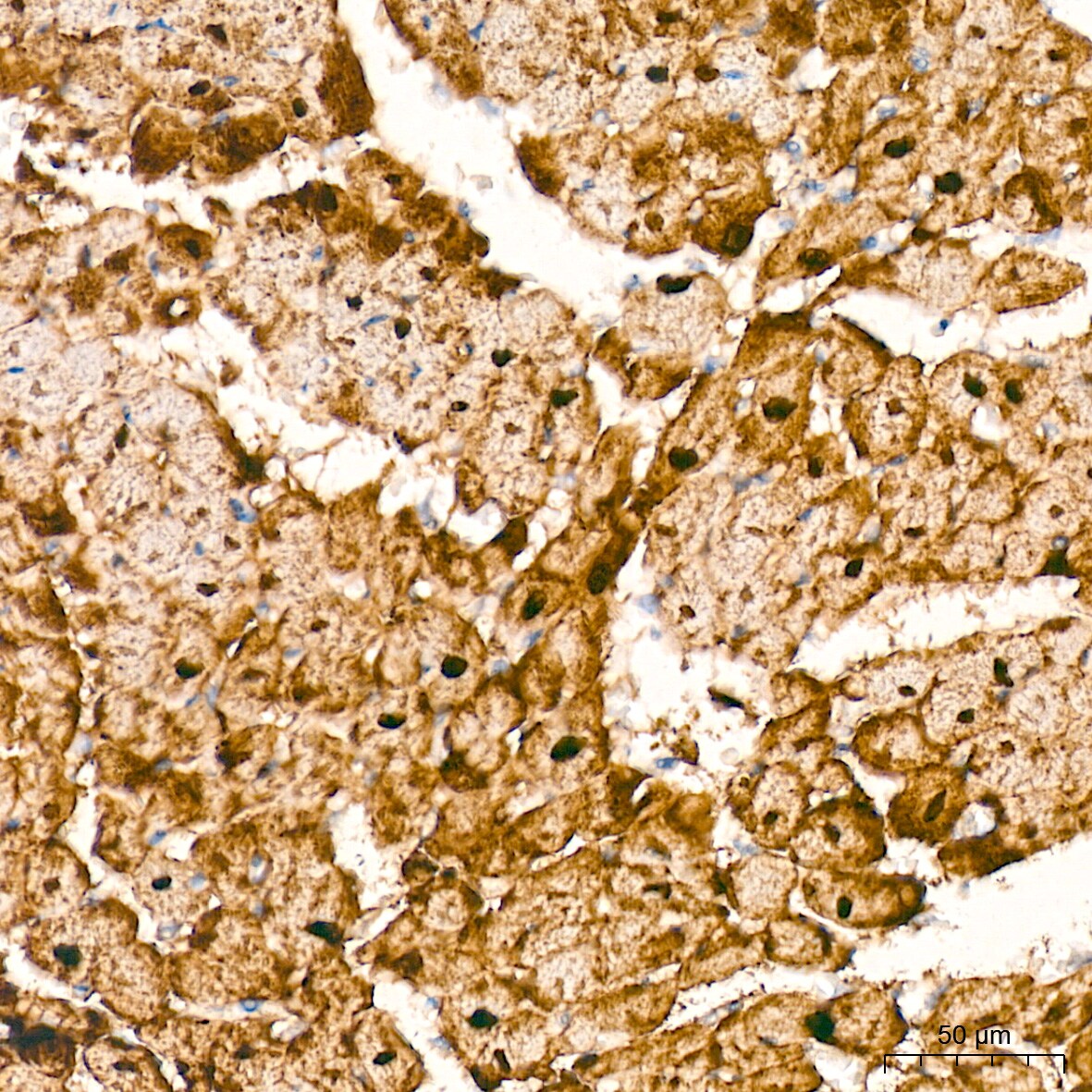 HSP20/HSPB6 Antibody (3J5N1)