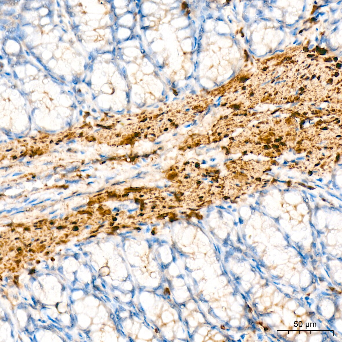HSP20/HSPB6 Antibody (3J5N1)