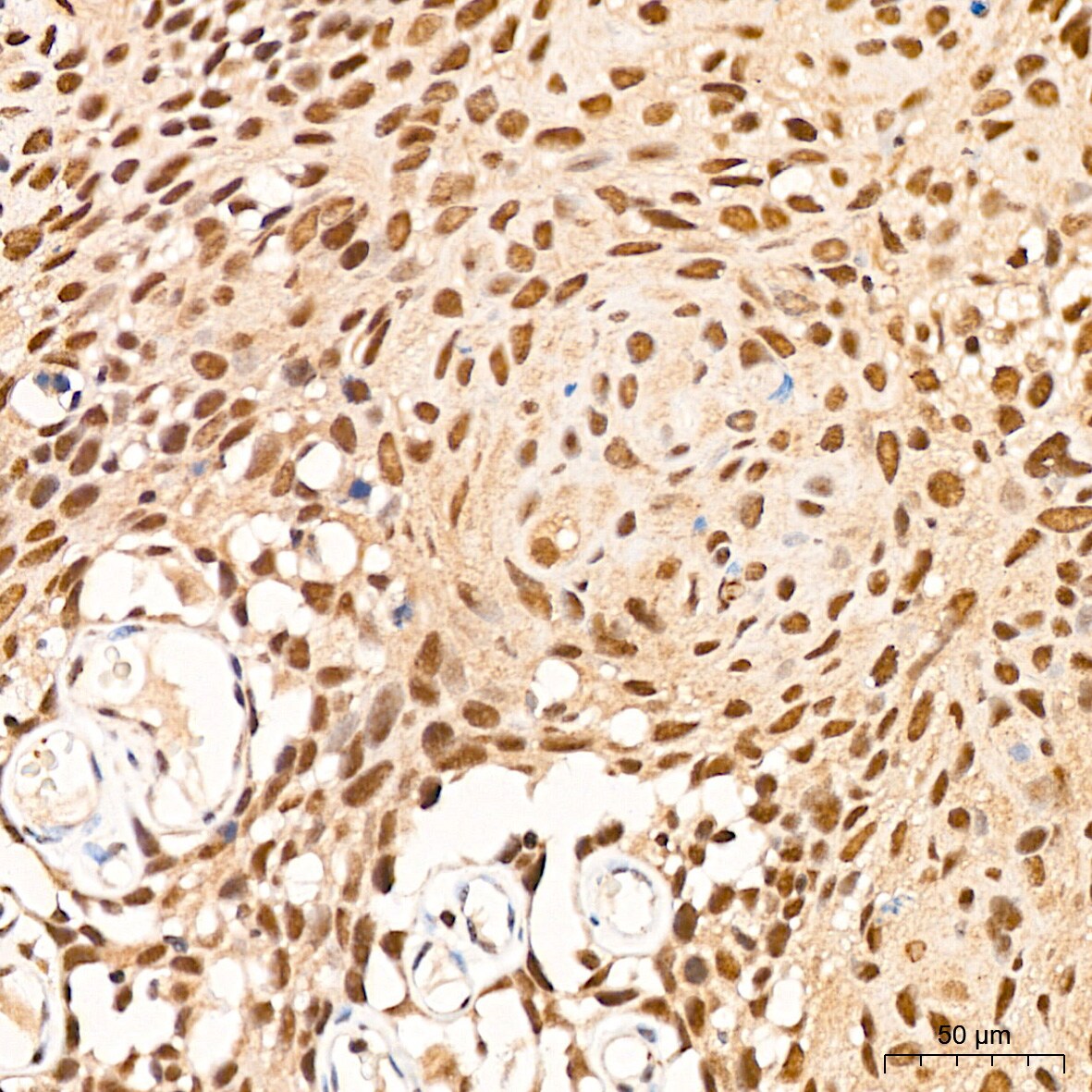 p70 S6 Kinase beta/S6K2 Antibody (5D8F5)