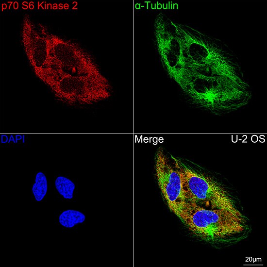 p70 S6 Kinase beta/S6K2 Antibody (5D8F5)