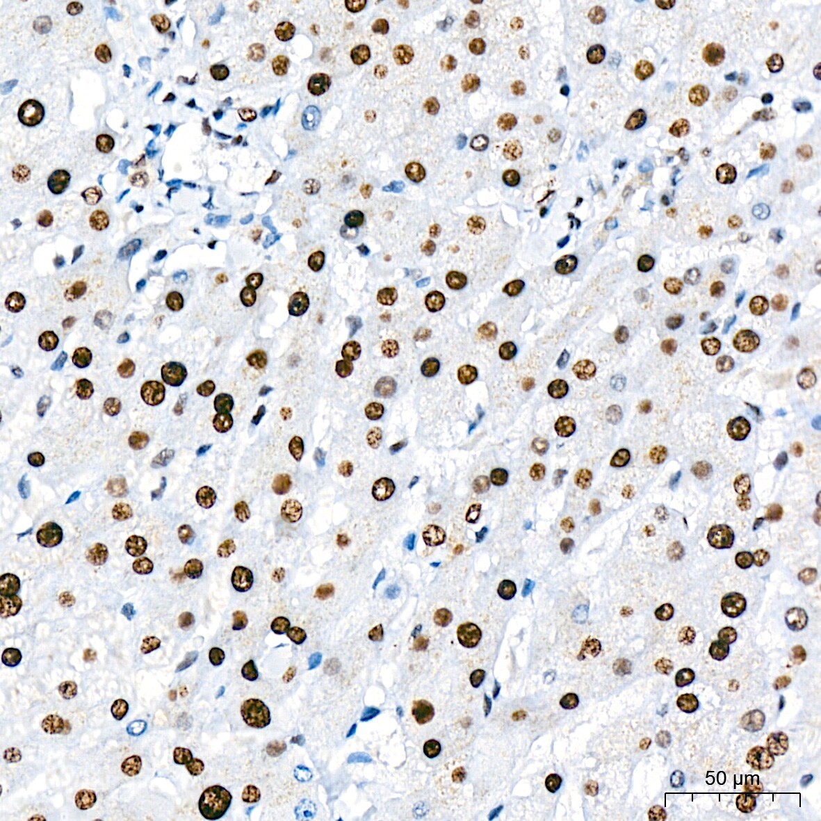 TRBP Antibody (9E6C9)