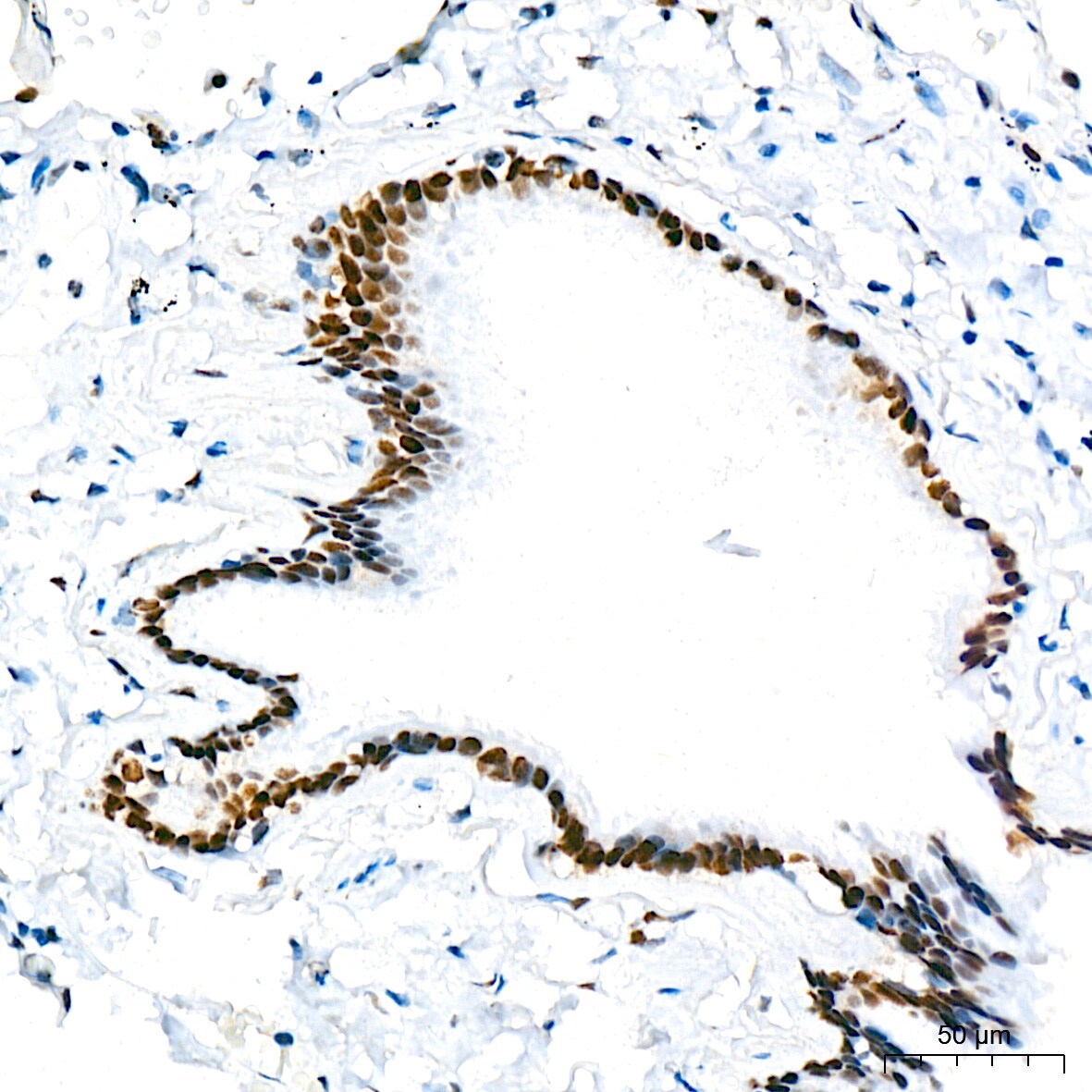 TRBP Antibody (9E6C9)