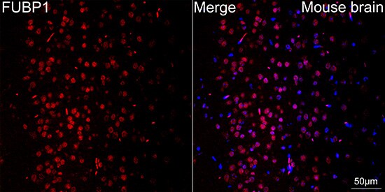 TRBP Antibody (9E6C9)