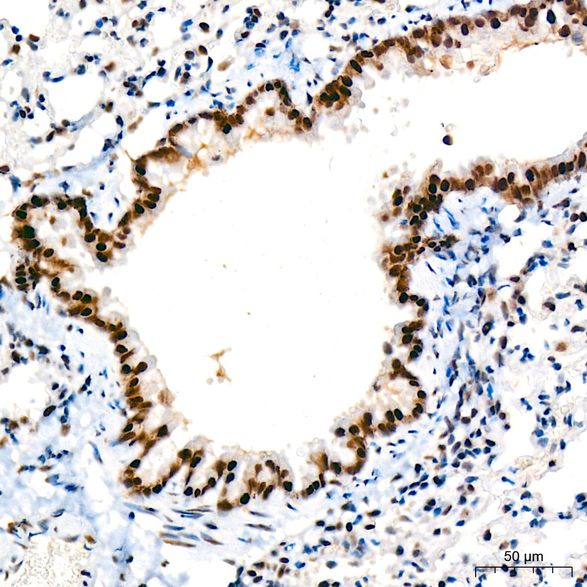 TRBP Antibody (9E6C9)