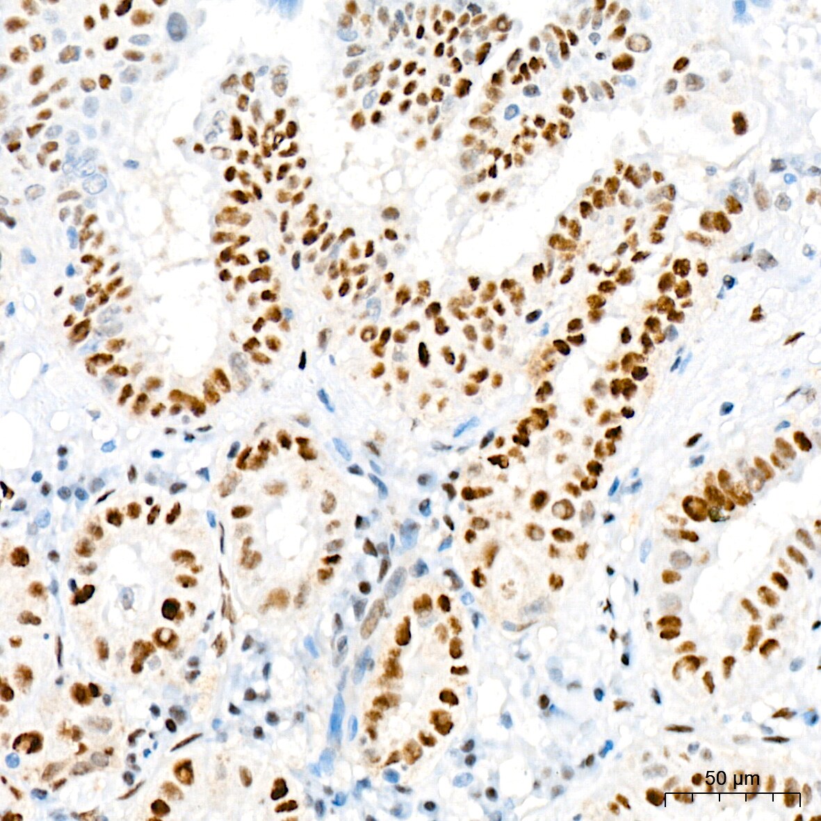 TRBP Antibody (9E6C9)