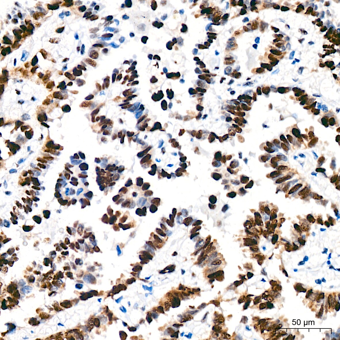 TRBP Antibody (9E6C9)