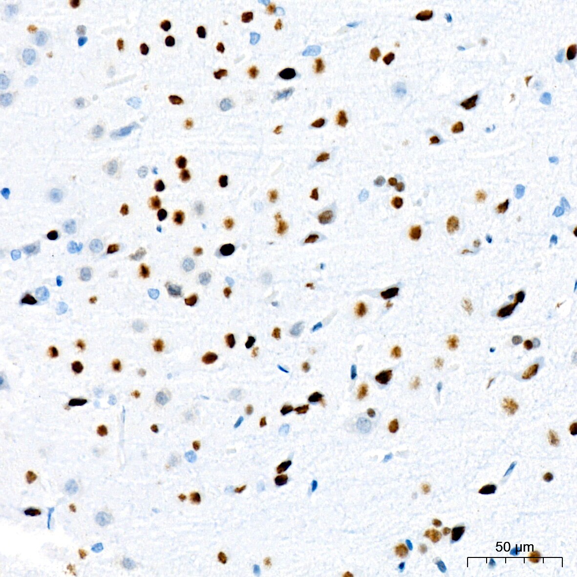 TRBP Antibody (9E6C9)