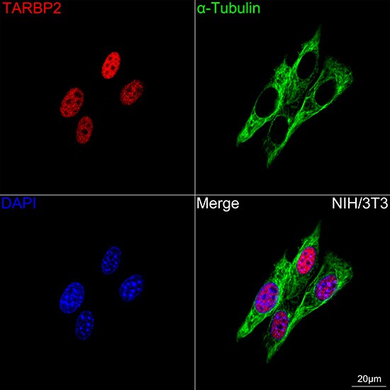TRBP Antibody (9E6C9)