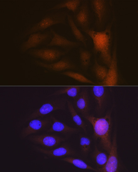 Musashi-1 Antibody (9S7Y1)