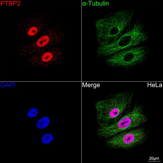 PTBP2 Antibody (10S9P6)
