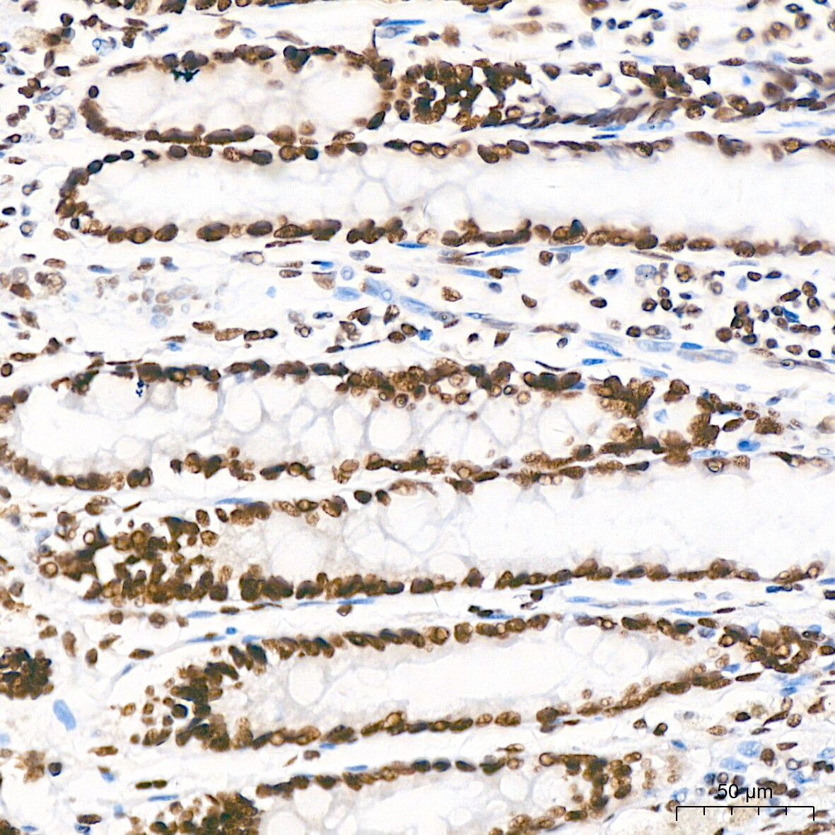 PTBP2 Antibody (10S9P6)