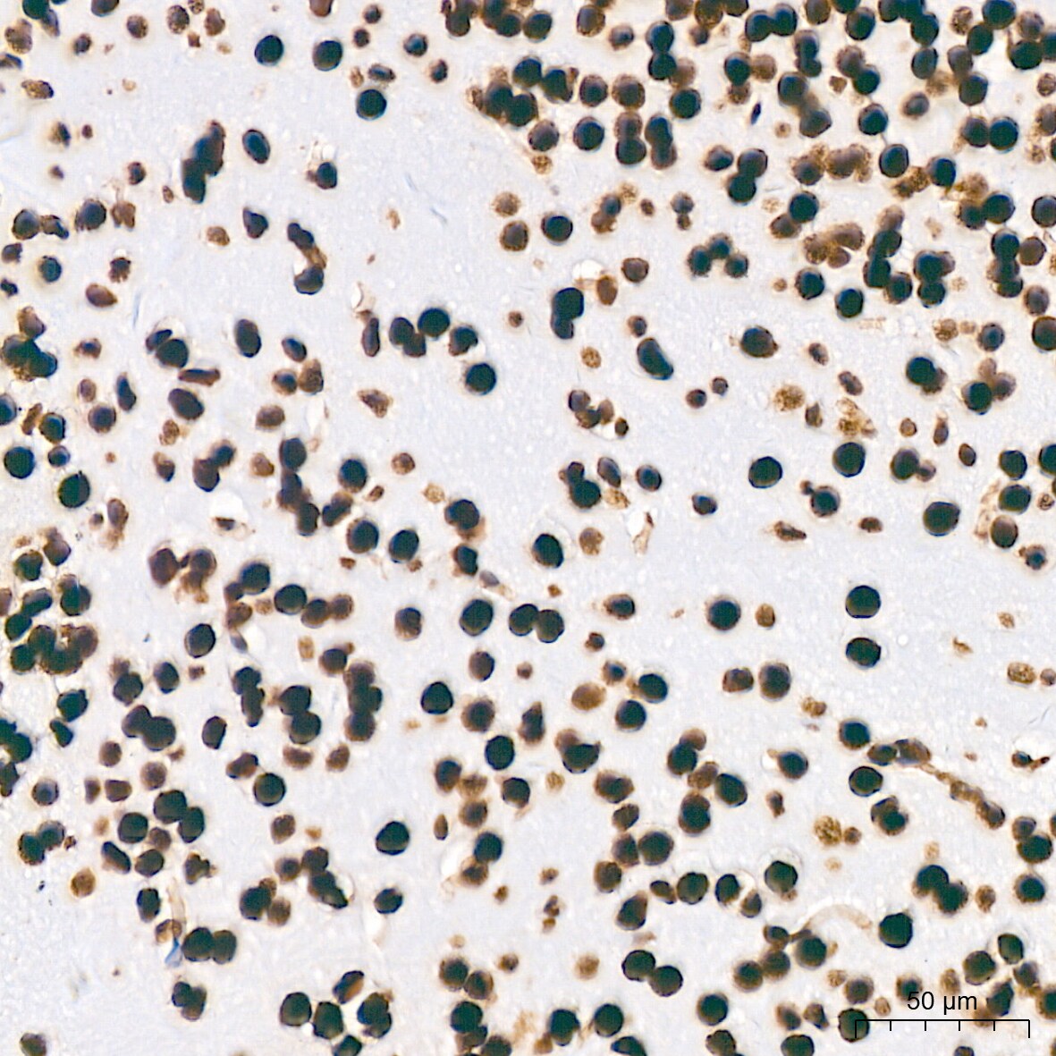 PTBP2 Antibody (10S9P6)