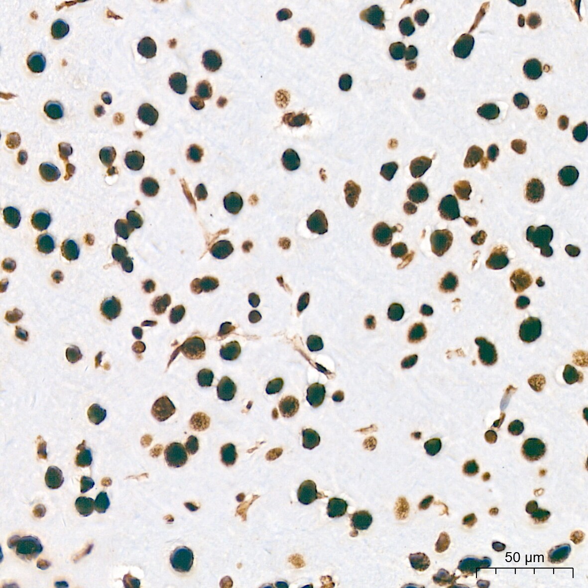 PTBP2 Antibody (10S9P6)