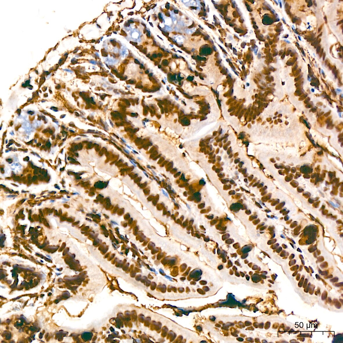 PTBP2 Antibody (10S9P6)