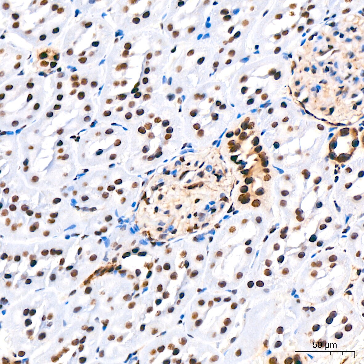 PTBP2 Antibody (10S9P6)