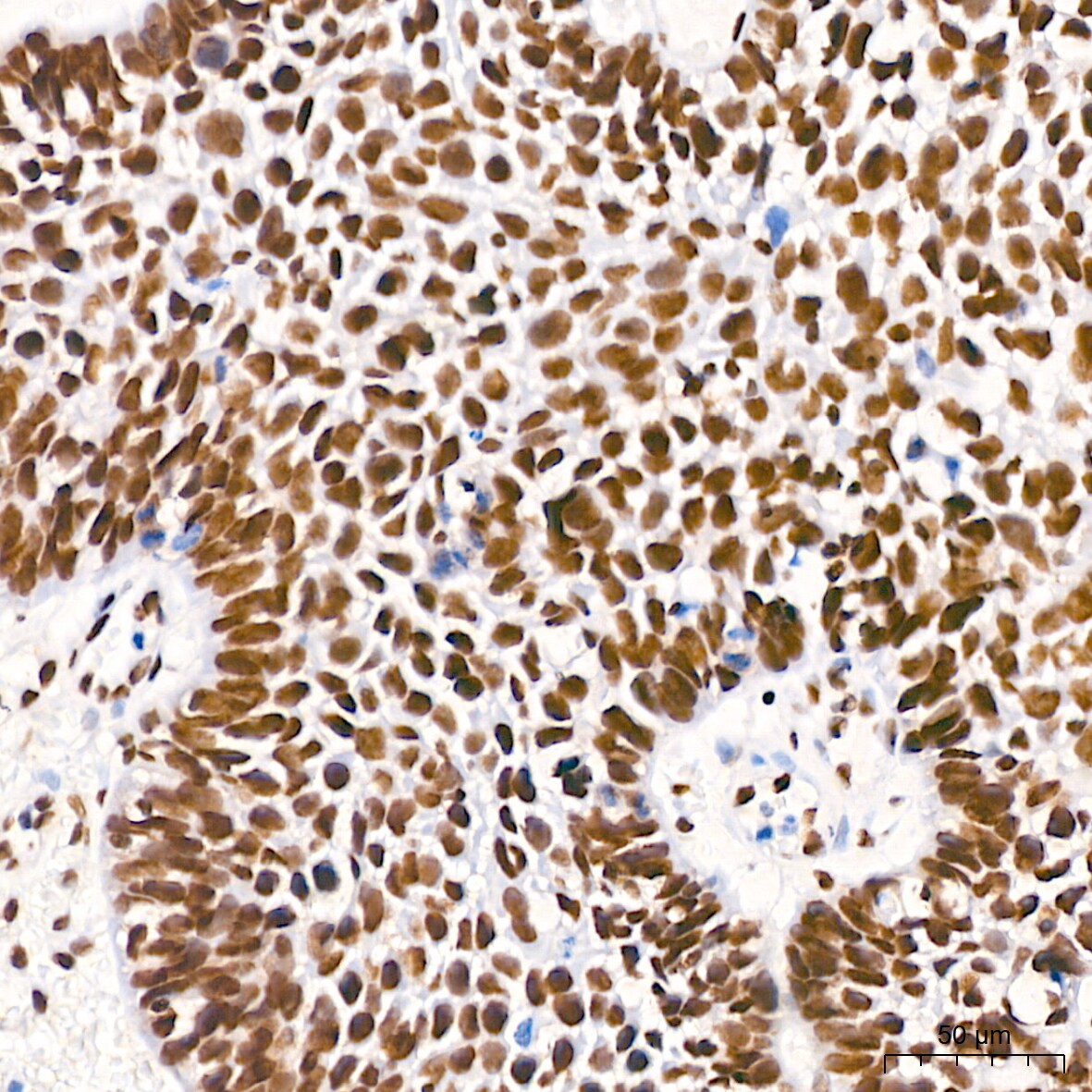 PTBP2 Antibody (10S9P6)