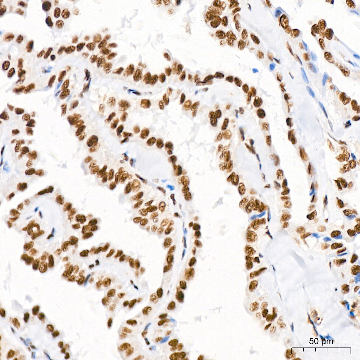 PTBP2 Antibody (10S9P6)