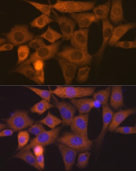NCK1 Antibody (4R1N9)