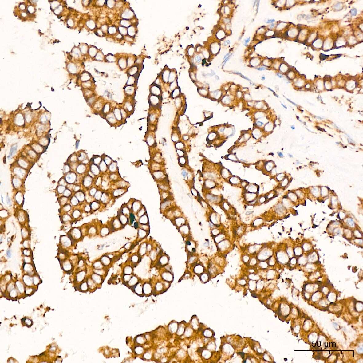 Peroxiredoxin 4 Antibody (9E7V0)