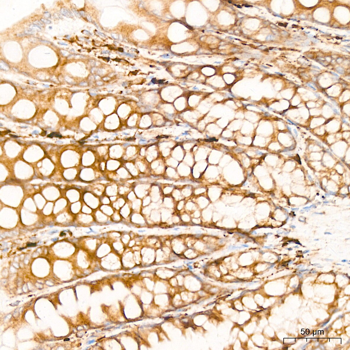 Peroxiredoxin 4 Antibody (9E7V0)