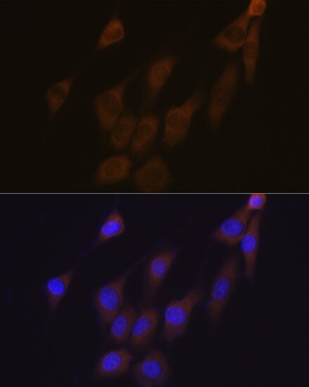 Peroxiredoxin 4 Antibody (9E7V0)
