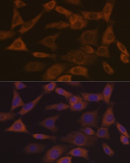 Ephrin-A1 Antibody (5D4Q5)