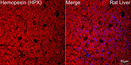 Hemopexin Antibody (1M6O3)