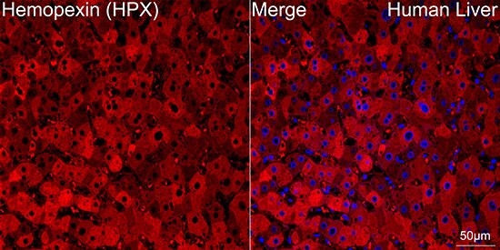 Hemopexin Antibody (1M6O3)