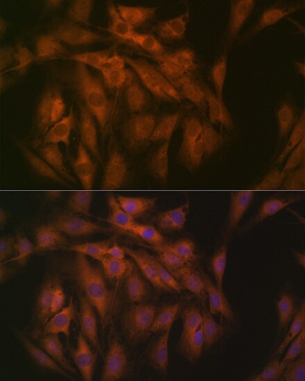 EIF3B Antibody (4T9V1)