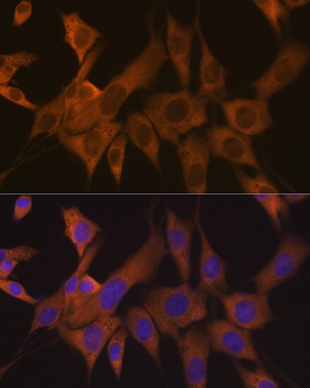 EIF3B Antibody (4T9V1)