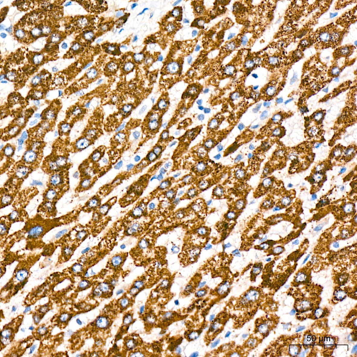 ABAT Antibody (10V1K9)