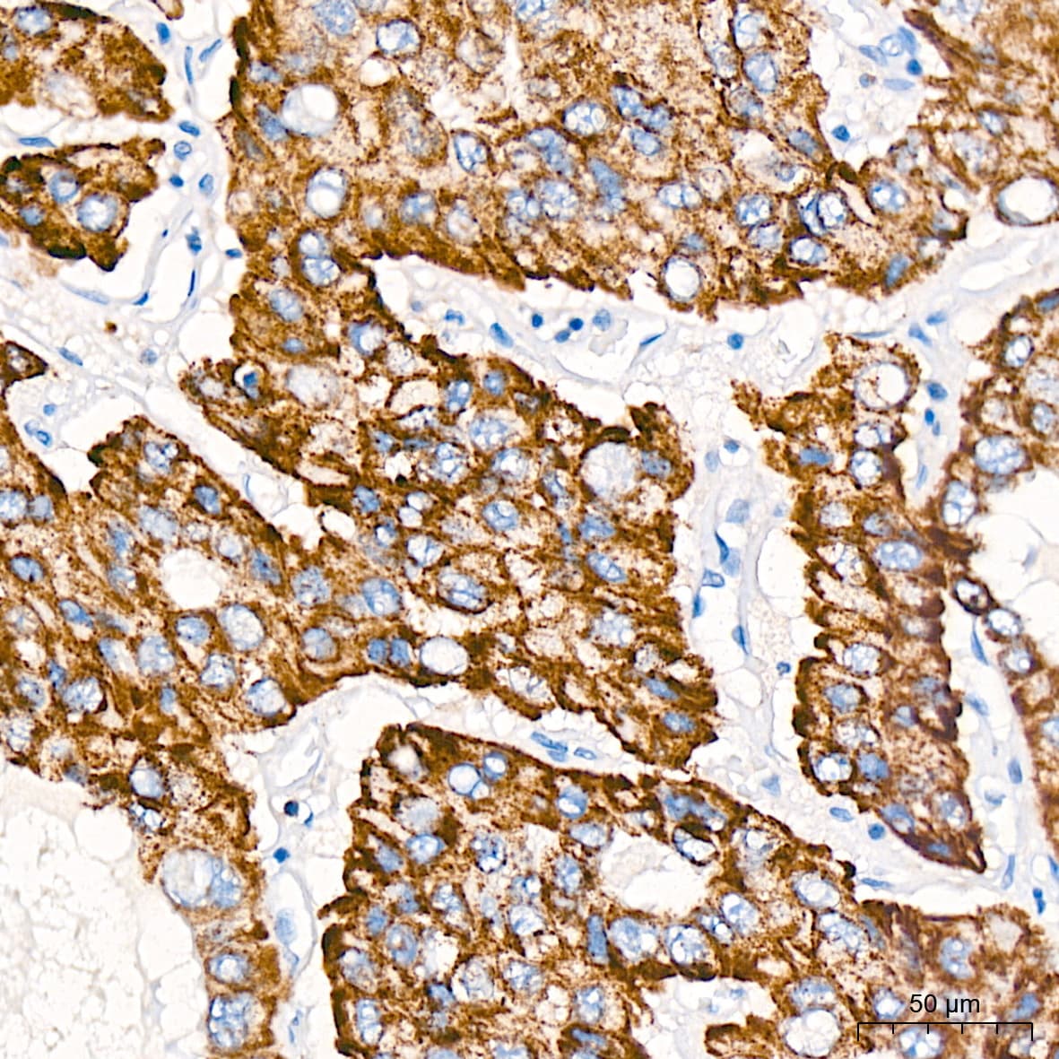 ABAT Antibody (10V1K9)