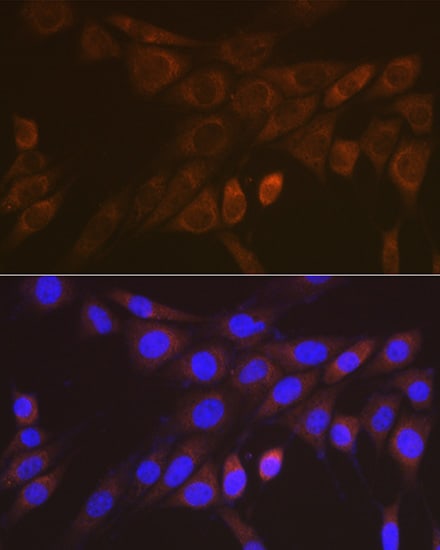 14-3-3 zeta/beta Antibody (3J3J9)