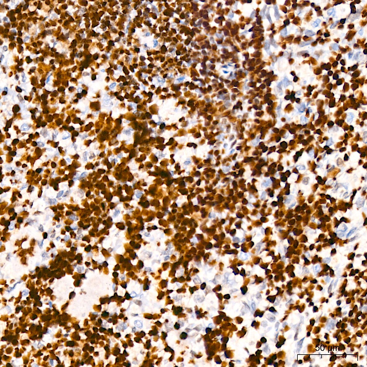 HMGB2 Antibody (8P10V5)