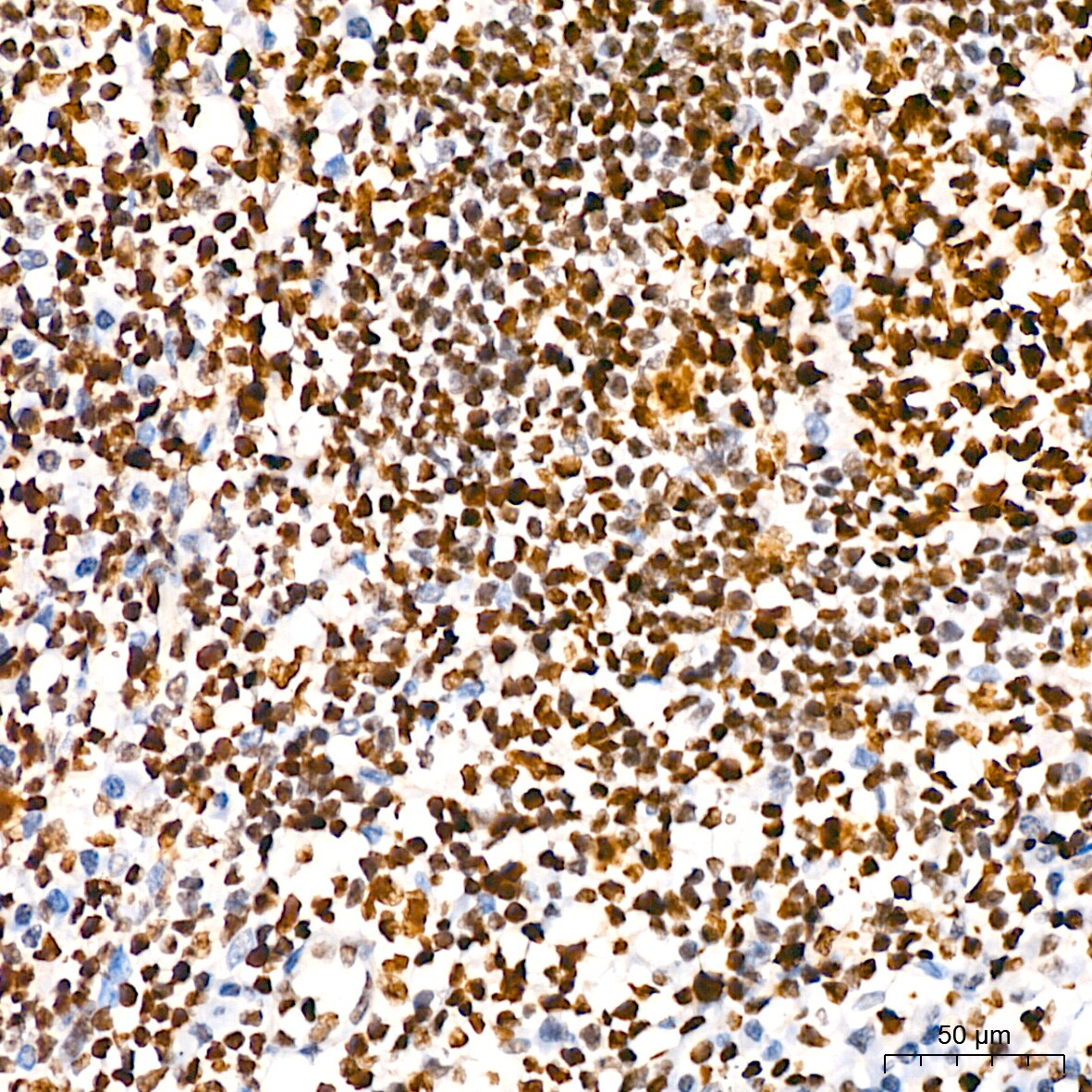 HMGB2 Antibody (8P10V5)