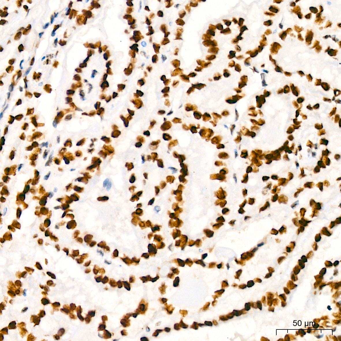 HMGB2 Antibody (8P10V5)