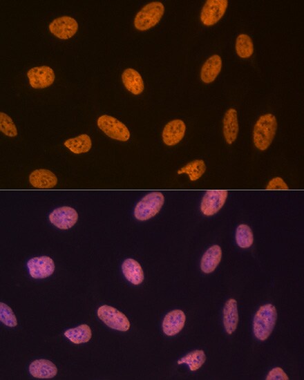 SET Antibody (8E8M9)