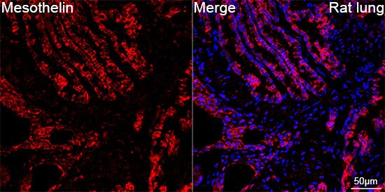 Mesothelin Antibody (5R9H8)