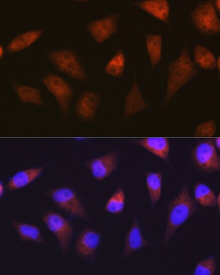 PSMA2 Antibody (6L5H4)