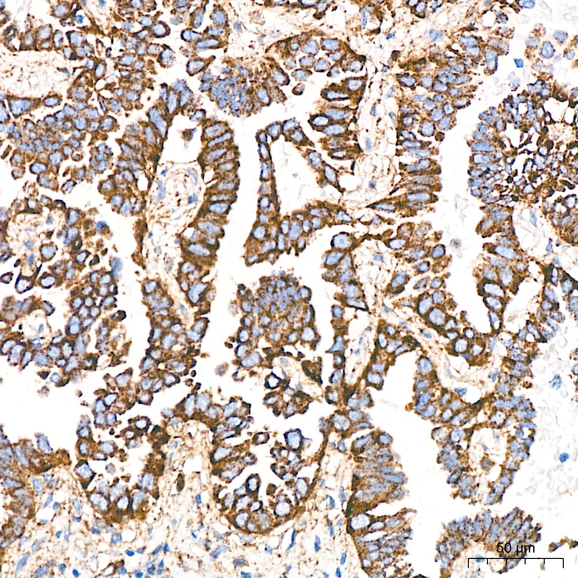 LIMPII/SR-B2 Antibody (7D2P5)