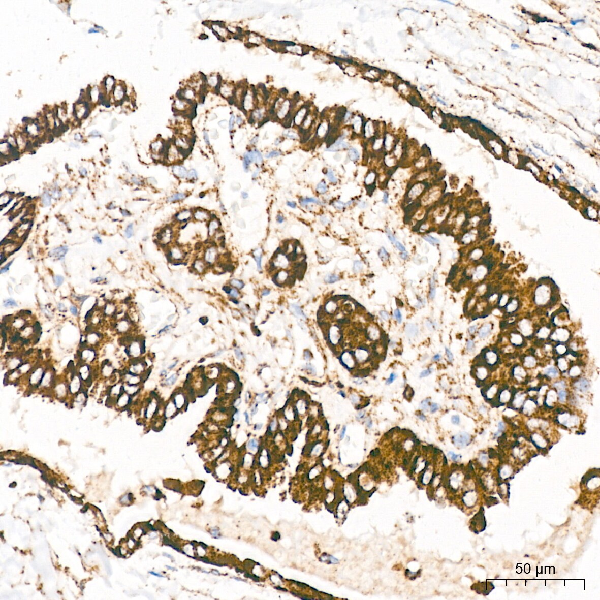 LIMPII/SR-B2 Antibody (7D2P5)