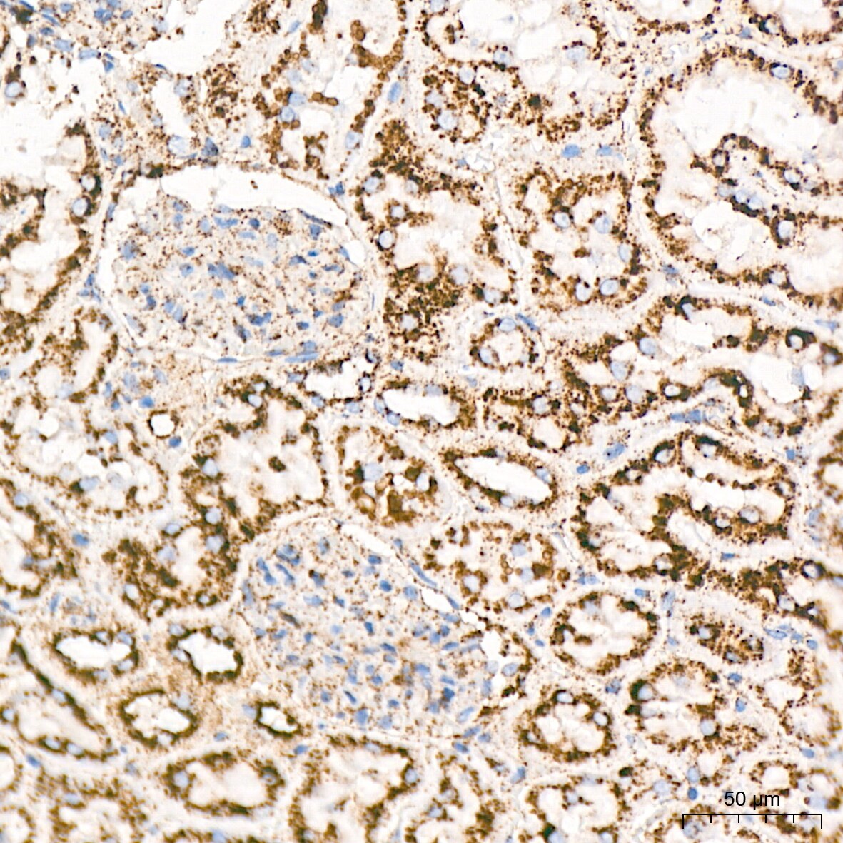 LIMPII/SR-B2 Antibody (7D2P5)