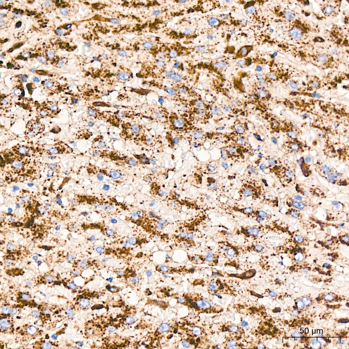 LIMPII/SR-B2 Antibody (7D2P5)