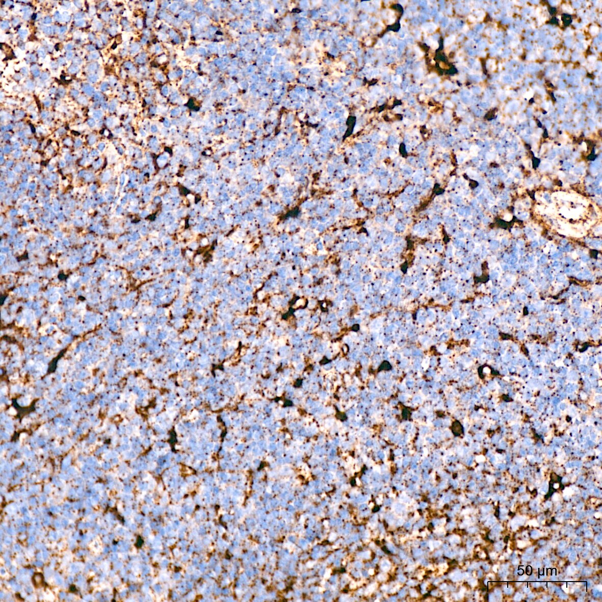 LIMPII/SR-B2 Antibody (7D2P5)