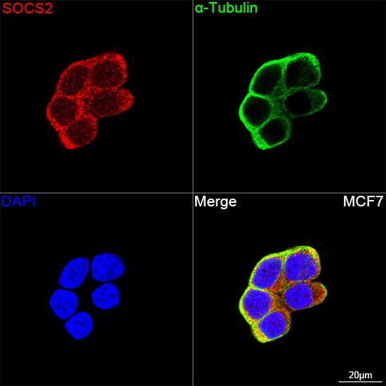 SOCS-2 Antibody (6D3F6)