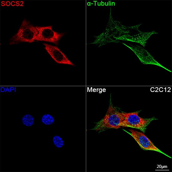 SOCS-2 Antibody (6D3F6)