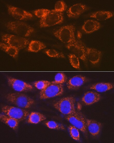 ARF1 Antibody (0C5B3)
