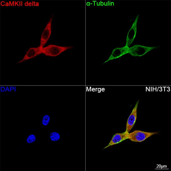 CaM Kinase II delta Antibody (10M1P2)